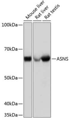 Western Blot: Asparagine synthetase Antibody (7M10Z7) [NBP3-15328] - Western blot analysis of extracts of various cell lines, using Asparagine synthetase Rabbit mAb (NBP3-15328) at 1:1000 dilution. Secondary antibody: HRP Goat Anti-Rabbit IgG (H+L) at 1:10000 dilution. Lysates/proteins: 25ug per lane. Blocking buffer: 3% nonfat dry milk in TBST. Detection: ECL Basic Kit. Exposure time: 3s.