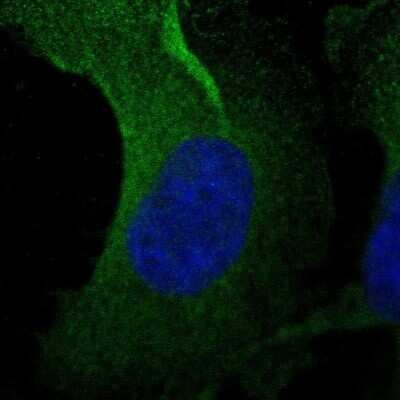 Immunocytochemistry/Immunofluorescence: Asparagine synthetase Antibody [NBP2-55125] - Staining of human cell line U-251 MG shows localization to cytosol.