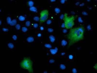 Immunocytochemistry/Immunofluorescence: Asparagine synthetase Antibody (OTI1A10) - Azide and BSA Free [NBP2-70215] - Staining of COS7 cells transiently transfected by pCMV6-ENTRY Asparagine synthetase.