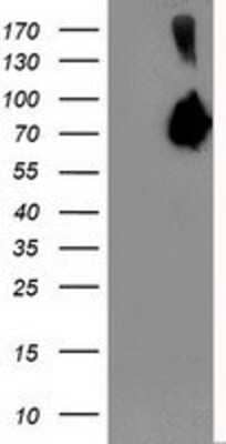 Western Blot: Asparagine synthetase Antibody (OTI1A10) - Azide and BSA Free [NBP2-70215] - HEK293T cells were transfected with the pCMV6-ENTRY control (Left lane) or pCMV6-ENTRY Asparagine synthetase (Right lane) cDNA for 48 hrs and lysed. Equivalent amounts of cell lysates (5 ug per lane) were separated by SDS-PAGE and immunoblotted with anti