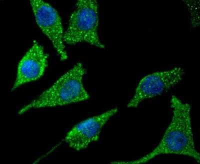 Immunocytochemistry/Immunofluorescence: Asparagine synthetase Antibody (SC67-07) [NBP2-67593] - Staining Asparagine synthetase in SH-SY-5Y cells (green). The nuclear counter stain is DAPI (blue). Cells were fixed in paraformaldehyde, permeabilised with 0.25% Triton X100/PBS.