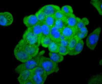 Immunocytochemistry/Immunofluorescence: Asparagine synthetase Antibody (SC67-07) [NBP2-67593] - Staining Asparagine synthetase in SW480 cells (green). The nuclear counter stain is DAPI (blue). Cells were fixed in paraformaldehyde, permeabilised with 0.25% Triton X100/PBS.