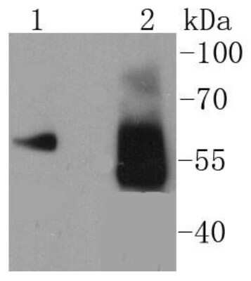 Western Blot: Asparagine synthetase Antibody (SC67-07) [NBP2-67593] - Analysis of Asparagine synthetase on different lysates using anti-Asparagine synthetase antibody at 1/1,000 dilution. Positive control: Lane 1: K562 Lane 2: Human skeletal muscle
