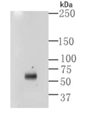 Western Blot: Asparagine synthetase Antibody (SC67-07) [NBP2-67593] - Western blot analysis of Asparagine synthetase on human lung using anti-Asparagine synthetase antibody at 1/500 dilution.