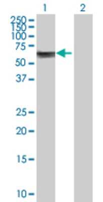 Western Blot: Asparagine synthetase Antibody [H00000440-D01P] - Analysis of ASNS expression in transfected 293T cell line by ASNS polyclonal antibody.Lane 1: ASNS transfected lysate(64.40 KDa).Lane 2: Non-transfected lysate.