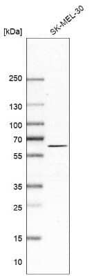 Western Blot: Asparagine synthetase Antibody [NBP1-87444] - Analysis in human cell line SK-MEL-30.