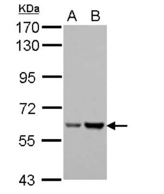 Western Blot: Asparagine synthetase Antibody [NBP2-14879] - Sample (30 ug of whole cell lysate)  A: Raji  B: K562  7.5% SDS PAGE diluted at 1:5000 