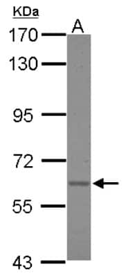 Western Blot: Asparagine synthetase Antibody [NBP2-14880] - Sample (30 ug of whole cell lysate) A: A431 7. 5% SDS PAGE; antibody diluted at 1:1000.