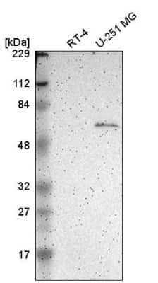 Western Blot: Asparagine synthetase Antibody [NBP2-55125] - Western blot analysis in human cell line RT-4 and human cell line U-251 MG.