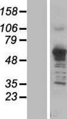 Western Blot: Asparagine synthetase Overexpression Lysate (Adult Normal) [NBP2-04785] Left-Empty vector transfected control cell lysate (HEK293 cell lysate); Right -Over-expression Lysate for Asparagine synthetase.