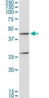 Western Blot: Aspartate Aminotransferase Antibody [H00002805-D01P] - Analysis of GOT1 expression in mouse kidney.