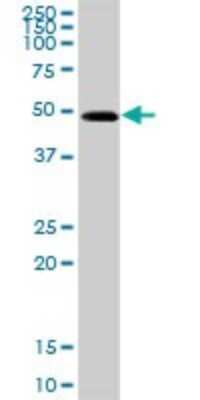 Western Blot: Aspartate Aminotransferase Antibody [H00002805-D01P] - Analysis of GOT1 expression in mouse testis.