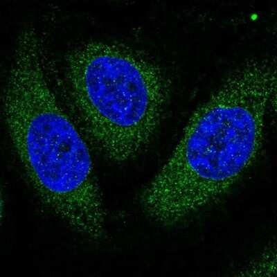 Immunocytochemistry/Immunofluorescence: Aspartate beta hydroxylase Antibody [NBP2-58045] - Staining of human cell line HeLa shows localization to endoplasmic reticulum.