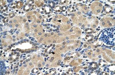 Immunohistochemistry: Aspartate beta hydroxylase Antibody [NBP1-69230] - Human kidney.