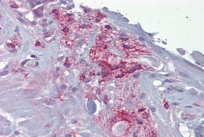 Immunohistochemistry: Aspartate beta hydroxylase Antibody [NBP3-10339] - Immunohistochemical analysis of myenteric plexus tissue of small intestine at an antibody concentration of 5ug/ml