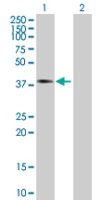 Western Blot: Aspartate beta hydroxylase Antibody [H00000444-B01P] - Analysis of ASPH expression in transfected 293T cell line by ASPH polyclonal antibody.  Lane 1: ASPH transfected lysate(29.81 KDa). Lane 2: Non-transfected lysate.