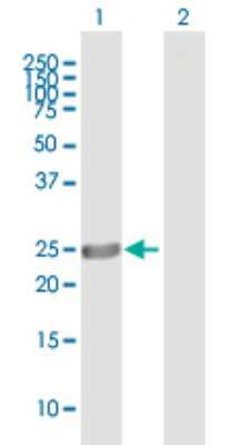 Western Blot: Aspartate beta hydroxylase Antibody [H00000444-B02P] - Analysis of ASPH expression in transfected 293T cell line by ASPH polyclonal antibody.  Lane 1: ASPH transfected lysate(23.1 KDa). Lane 2: Non-transfected lysate.