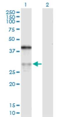 Western Blot: Aspartate beta hydroxylase Antibody [H00000444-D01P] - Analysis of ASPH expression in transfected 293T cell line by ASPH polyclonal antibody.Lane 1: ASPH transfected lysate(29.81 KDa).Lane 2: Non-transfected lysate.