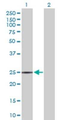 Western Blot: Aspartate beta hydroxylase Antibody [H00000444-D03P] - Analysis of ASPH expression in transfected 293T cell line by ASPH polyclonal antibody.Lane 1: ASPH transfected lysate(23.80 KDa).Lane 2: Non-transfected lysate.