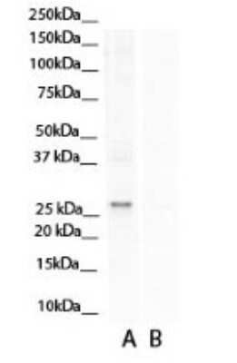 Western Blot: Aspartate beta hydroxylase Antibody [NBP1-69229] - Antibody  Titration: 0.2-1 ug/ml. A: - blocking peptide. B: + blocking peptide.