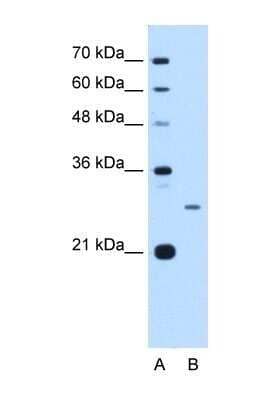 Western Blot: Aspartate beta hydroxylase Antibody [NBP1-69230] - This Anti-ASPH antibody was used in Western Blot of HepG2 tissue lysate at a concentration of 2.5ug/ml.