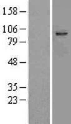 Western Blot: Aspartate beta hydroxylase Overexpression Lysate (Adult Normal) [NBL1-07773] Left-Empty vector transfected control cell lysate (HEK293 cell lysate); Right -Over-expression Lysate for Aspartate beta hydroxylase.