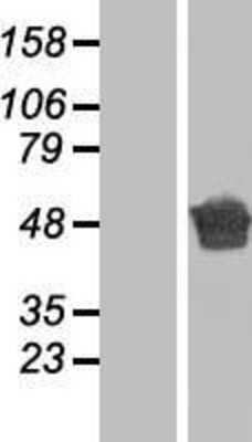 Western Blot: Aspartate beta hydroxylase Overexpression Lysate (Adult Normal) [NBP2-06019] Left-Empty vector transfected control cell lysate (HEK293 cell lysate); Right -Over-expression Lysate for Aspartate beta hydroxylase.