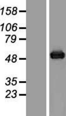 Western Blot: Aspartate beta hydroxylase Overexpression Lysate (Adult Normal) [NBP2-06020] Left-Empty vector transfected control cell lysate (HEK293 cell lysate); Right -Over-expression Lysate for Aspartate beta hydroxylase.