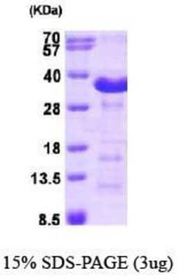 SDS-Page: Recombinant Human Aspartate beta hydroxylase Protein [NBP1-40403] -  ASPH, 24.5 kDa (217aa), confirmed by MALDI-TOF with a purity of 90% by SDS - PAGE