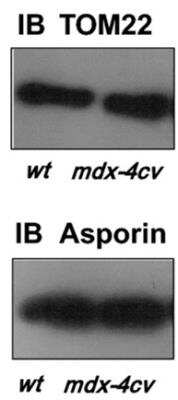 Western Blot Asporin Antibody