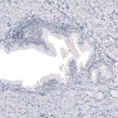 Immunohistochemistry-Paraffin: Astrin Antibody (CL10078) [NBP2-88942] - Staining of human prostate shows no cytoplasmic positivity in glandular cells as expected.