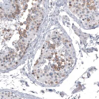 Immunohistochemistry-Paraffin: Astrin Antibody (CL10078) [NBP2-88942] - Staining of human testis shows moderate cytoplasmic positivity in cells in seminiferous ducts.