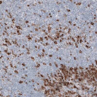 Immunohistochemistry-Paraffin: Astrin Antibody (CL10078) [NBP2-88942] - Staining of human tonsil shows strong cytoplasmic positivity in non-germinal center cells.
