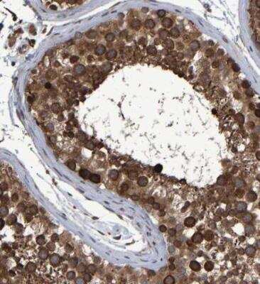Immunohistochemistry-Paraffin: Astrin Antibody [NBP1-85262] - Staining of human testis shows strong cytoplasmic positivity in cells in seminiferous ducts.