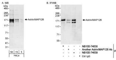 Western Blot: Astrin Antibody [NB100-74639] - Detection of Human Astrin/MAP126 by Western Blot and  Immunoprecipitation. Samples: Whole cell lysate (5, 15 and 50  mcg for WB; 1 mg for IP, 20% of IP loaded) from HeLa cells.  Antibodies: Affinity purified rabbit anti-Astrin/MAP126 antibody  NB100-74639 used for WB at 0.04 mcg/ml (A) and 0.1 mcg/ml (B)  and used for IP at 3 mcg/mg lysate. Astrin/MAP126 was also  immunoprecipitated by another  rabbit anti-Astrin/MAP126 antibody and NB100-74638 , which recognize upstream epitopes.  Detection: Chemiluminescence with exposure times of 30  seconds (A and B).