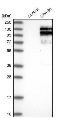 Western Blot: Astrin Antibody [NBP1-85262] - Analysis in control (vector only transfected HEK293T lysate) and SPAG5 over-expression lysate (Co-expressed with a C-terminal myc-DDK tag (3.1 kDa) in mammalian HEK293T cells).