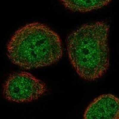 Immunocytochemistry/Immunofluorescence: Atad5 Antibody [NBP3-17568] - Staining of human cell line HaCaT shows localization to nucleoplasm, cytosol, centriolar satellites & cytokinetic bridge.