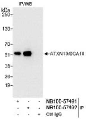 Immunoprecipitation: Ataxin-10 Antibody [NB100-57491] - Detection of Human Ataxin-10 by Western Blot of Immunoprecipitates. Whole cell lysates from Hela cells loaded (1 mg, 20% of IP). Ataxin-10 antibody (NB100-57491) used for IP at 3 ug/mg lysate. Ataxin-10 was also immunoprecipitated by rabbit Ataxin-10 antibody NB100-57492, which recognizes a downstream epitope. For blotting NB100-57492 was used at 0.1 ug/ml.