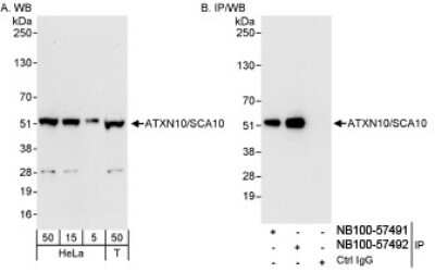 Immunoprecipitation: Ataxin-10 Antibody [NB100-57492] - Detection of Human ATXN10/SCA10 on HeLa whole cell lysates using NB100-57492. ATXN10/SCA10 was also immunoprecipitated by rabbit anti-ATXN10/SCA10 antibody NB100-57491.