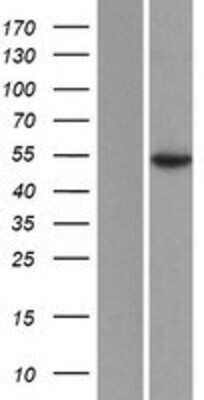 Western Blot: Ataxin-10 Overexpression Lysate (Adult Normal) [NBP2-10349] Left-Empty vector transfected control cell lysate (HEK293 cell lysate); Right -Over-expression Lysate for Ataxin-10.