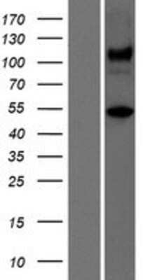 Western Blot: Ataxin-10 Overexpression Lysate (Adult Normal) [NBP2-11465] Left-Empty vector transfected control cell lysate (HEK293 cell lysate); Right -Over-expression Lysate for Ataxin-10.