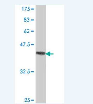 Western Blot: Ataxin-2 Antibody [H00006311-A01] - Detection against Immunogen (37.11 KDa) .