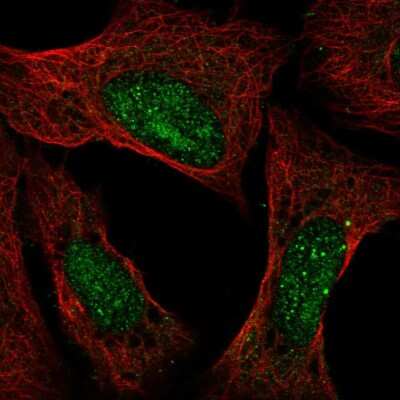 Immunocytochemistry/Immunofluorescence: Ataxin-3 Antibody [NBP2-56452] - Staining of human cell line U-2 OS shows localization to nucleus & nucleoli. Antibody staining is shown in green.