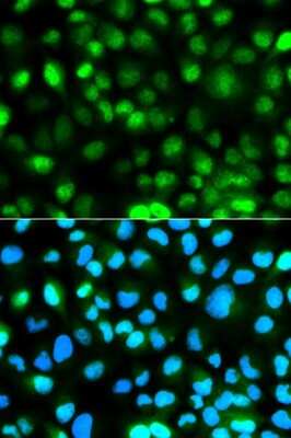 Immunocytochemistry/Immunofluorescence: Ataxin-3 Antibody [NBP2-92611] - Analysis of HeLa cells using Ataxin-3 . Blue: DAPI for nuclear staining.