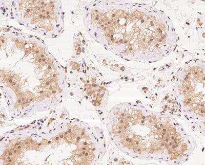 Immunohistochemistry-Paraffin: Ataxin-3 Antibody [NBP3-12686] -  Staining of human ATXN3 in human testis with rabbit polyclonal antibody at 1:100 dilution. 