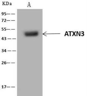 Immunoprecipitation: Ataxin-3 Antibody [NBP3-12686] - Lane A:0.5 mg MCF­7 Whole Cell Lysate4 uL anti-ATXN3 rabbit polyclonal antibody and 60 ug of Immunomagnetic beads Protein A/G.Primary antibody:Anti-ATXN3 rabbit polyclonal antibody,at 1:100 dilution Secondary antibody:Clean-Blot IP Detection Reagent (HRP) at 1:1000dilutionDeveloped using the ECL technique.Performed under reducing conditions.Predicted band size: 42 kDaObserved band size :50 kDa