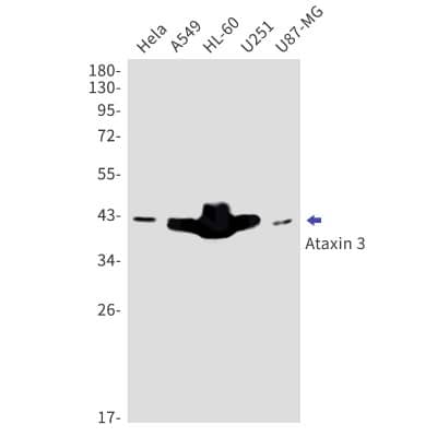 Western Blot: Ataxin-3 Antibody (S04-1I8) [NBP3-19834] - Western blot detection of Ataxin-3 in Hela, A549, HL-60, U251, U87-MG cell lysates using NBP3-19834 (1:1000 diluted). Predicted band size: 42kDa. Observed band size: 42kDa.