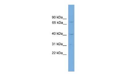 Western Blot: Ataxin-3 Antibody [NBP2-87047] - WB Suggested Anti-ATXN3 Antibody Titration: 0.2-1 ug/ml. Positive Control: 293T cell lysate