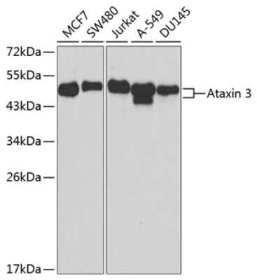 Western Blot: Ataxin-3 Antibody [NBP2-92611] - Analysis of extracts of various cell lines, using Ataxin-3 at 1:1000 dilution.Secondary antibody: HRP Goat Anti-Rabbit IgG (H+L) at 1:10000 dilution.Lysates/proteins: 25ug per lane.Blocking buffer: 3% nonfat dry milk in TBST.