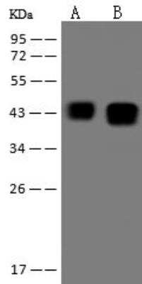 Western Blot: Ataxin-3 Antibody [NBP3-12686] - Lane A: U-87MG Whole Cell LysateLane B: MCF­7 Whole Cell LysateLysates/proteins at 30 ug per lane.SecondaryGoat Anti-Rabbit IgG (H+L)/HRP at 1/10000 dilution.Developed using the ECL technique.Performed under reducing conditions.Predicted band size:42 kDaObserved band size:42 kDa